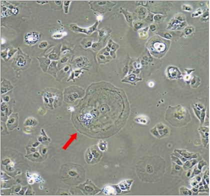 Molecular characterization of breast cancer cell lines in correlation ...